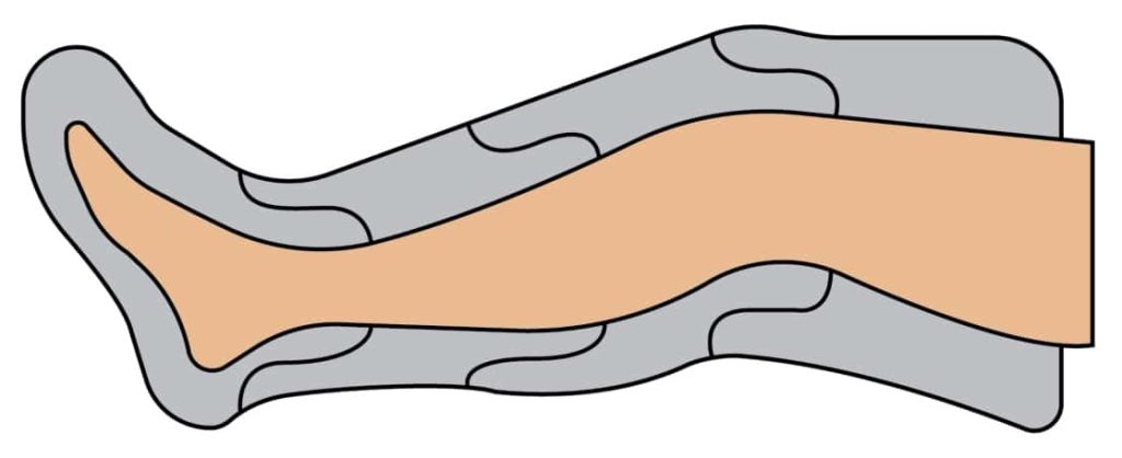 Recovery boots, hvordan fungerer recovery boots, kompressionsstøvler, restitution af benmusklerne, behandling, luftmassage